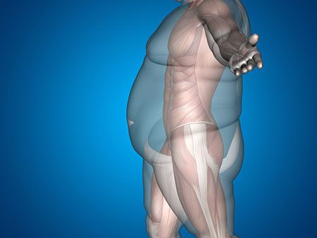 weight-mgmt-450 weight-mgmt-450